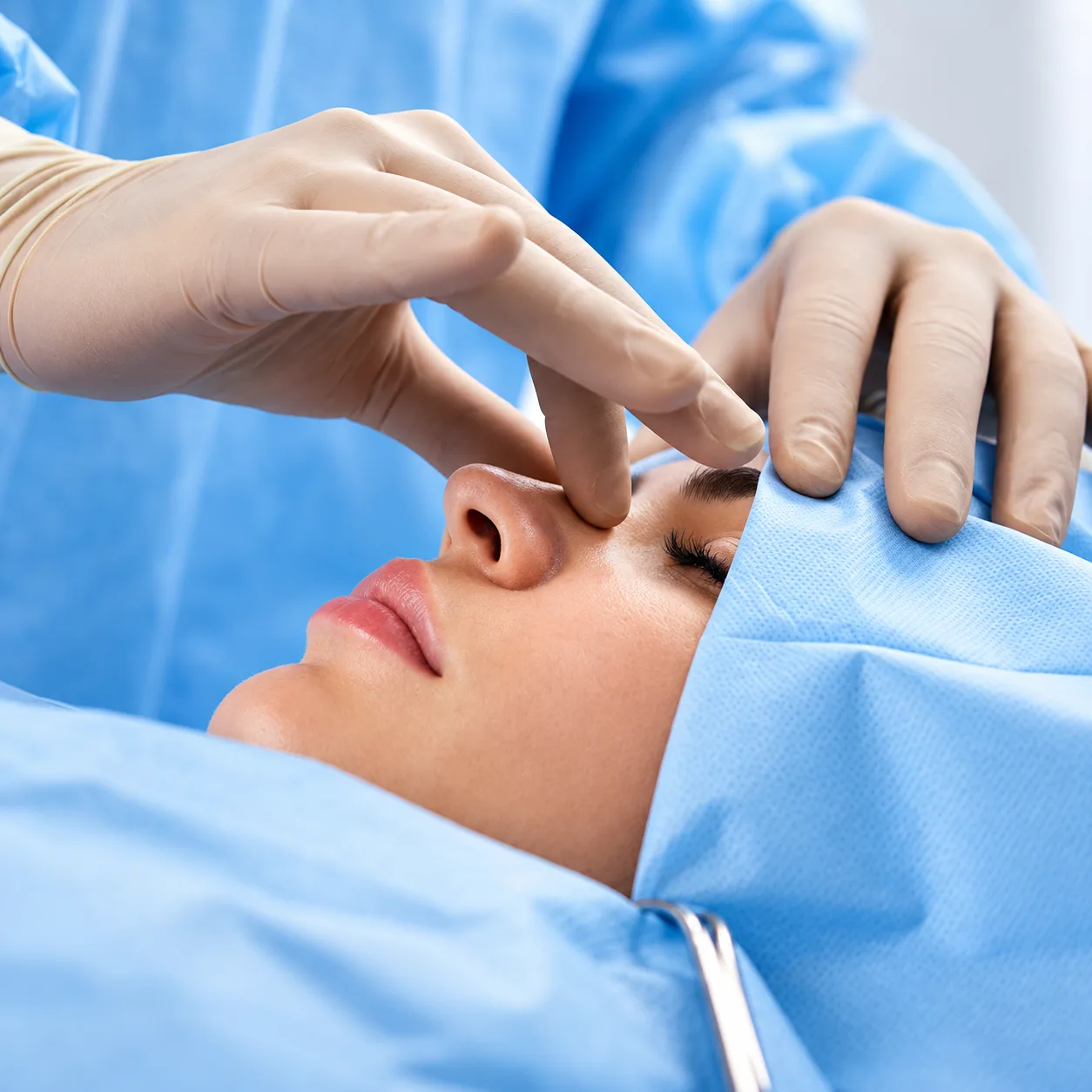 Rinoplastia
